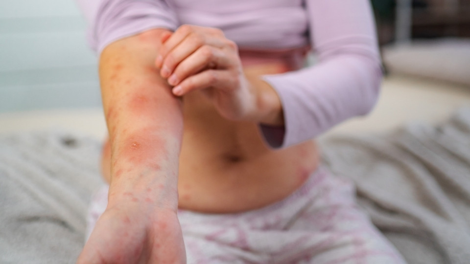 MMR symptoms
