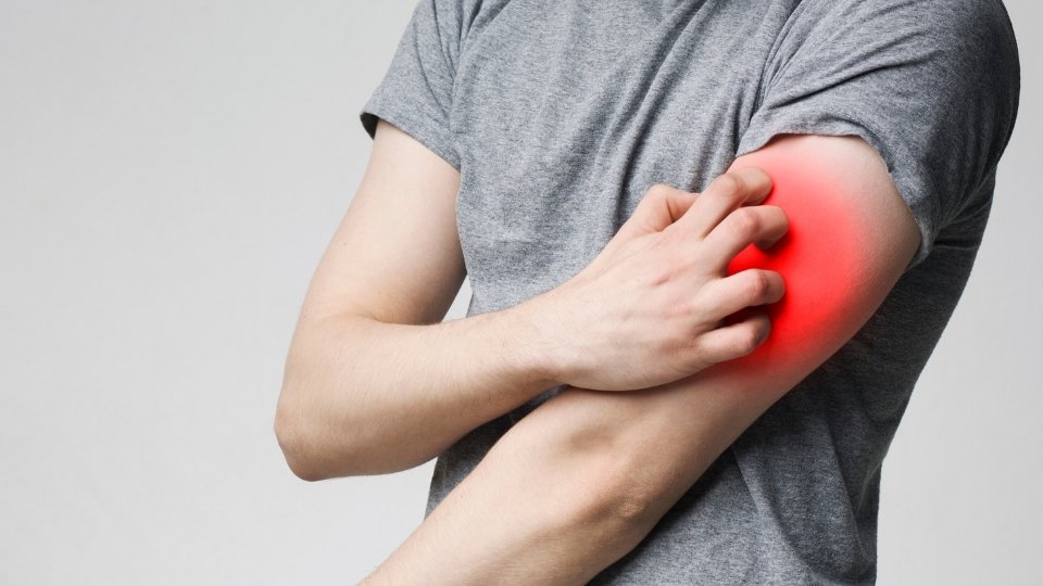 shingles symptoms